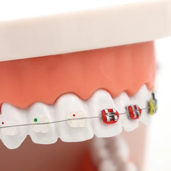 1pc Dantų Ortodontinis Modelis Pusė Keramikos Pusė Metalinis Laikiklis Su Anti-vinių Stomatologas, Medicinos Ligos Mokymo Studijų