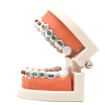 1pc Dantų Ortodontinis Modelis Pusė Keramikos Pusė Metalinis Laikiklis Su Anti-vinių Stomatologas, Medicinos Ligos Mokymo Studijų